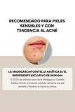 Serum Madagascar Centella Ampoule Calma y regenera tu piel Serum Madagascar Centella Ampoule Calma y regenera tu piel