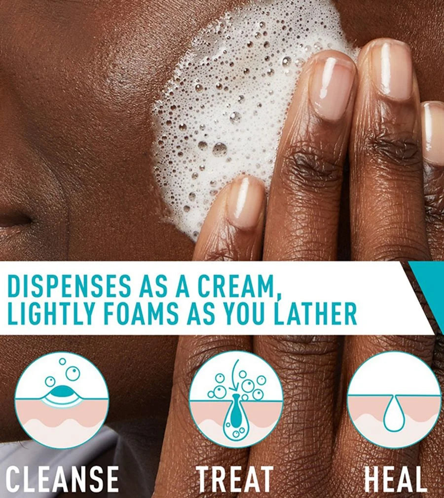 Acne Foaming Cream Cleanser Cerave 150ml